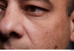 Eye Face Cheek Skin Man Birthmarks Chubby Studio photo references